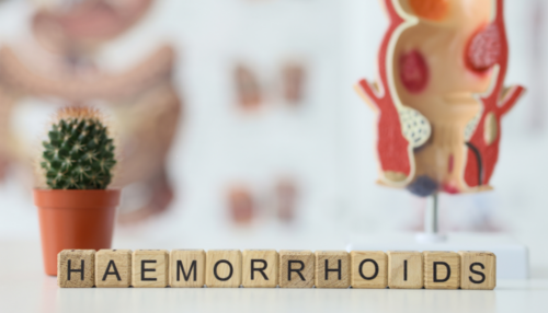 Laserowe, nowoczesne usuwanie hemoroidów (LHP) Gliwice